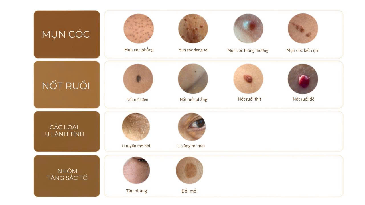Định vị công nghệ UNICE Beauty Tech
